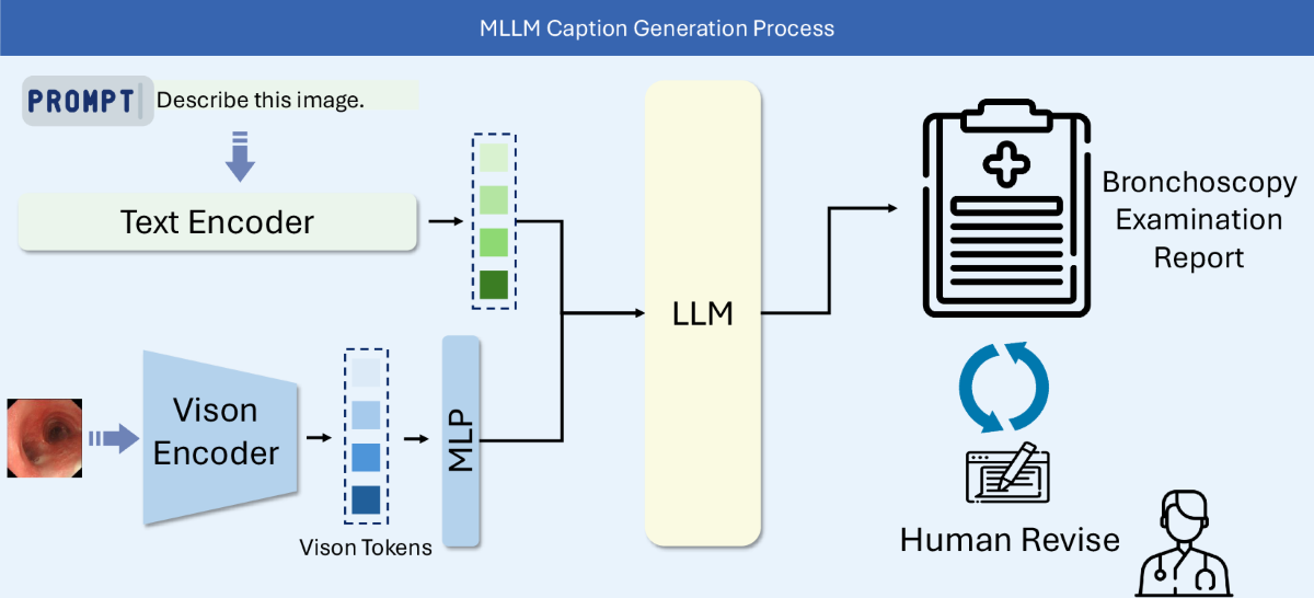 MLLM caption generation process producing a bronchoscopy examination report with human revision